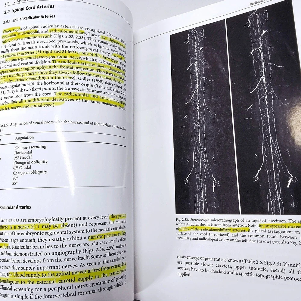 Springer Surgical Neuro-angiography 1 Clinical Vascular Anatomy‎ 2nd Ed GD